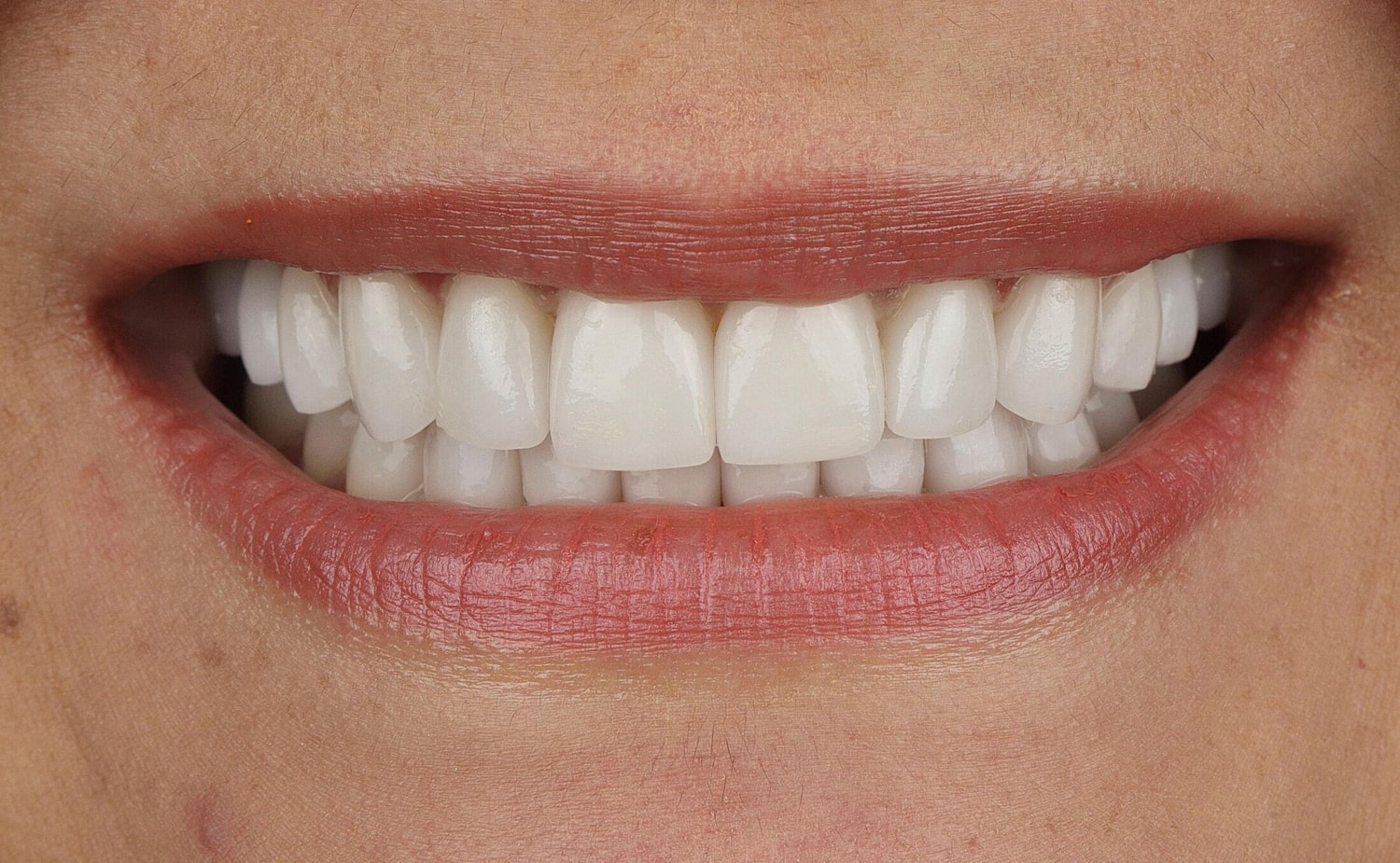 Patients Before & After
