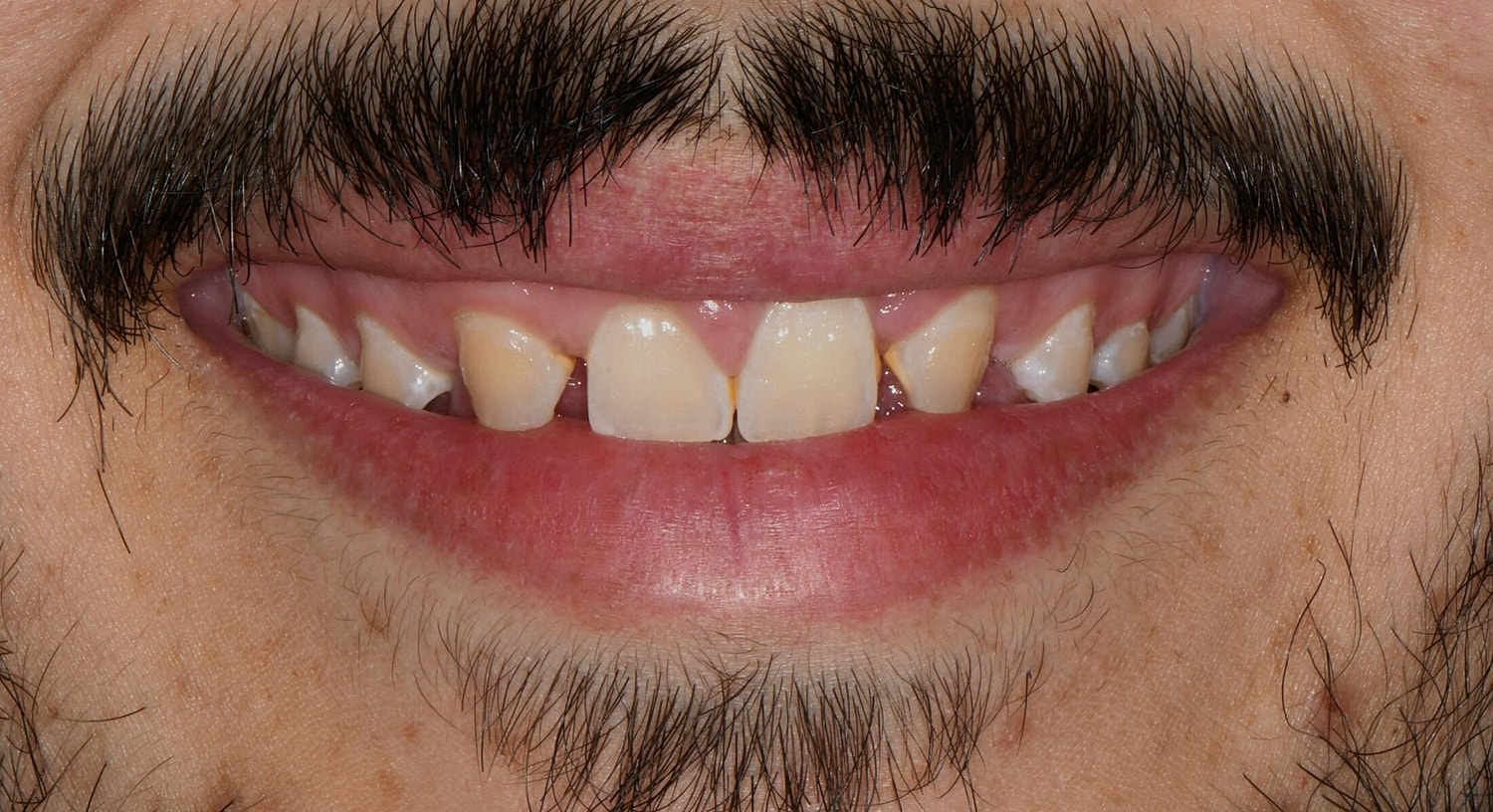 Patients Before & After