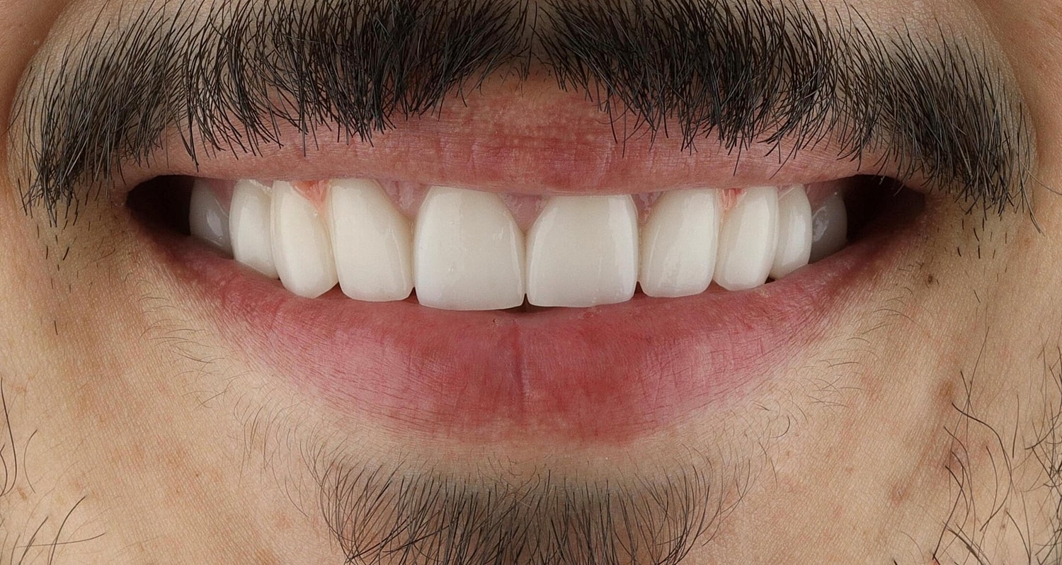 Patients Before & After