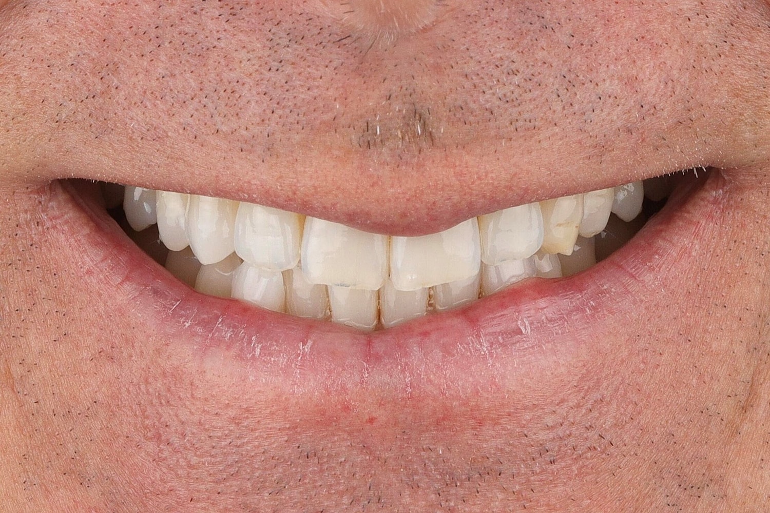 Patients Before & After