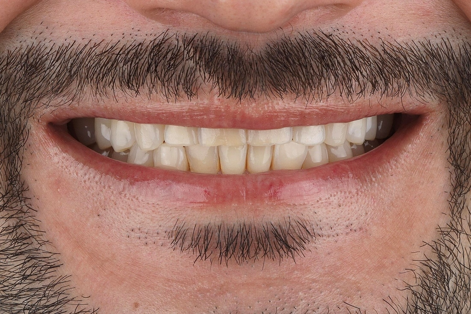 Patients Before & After