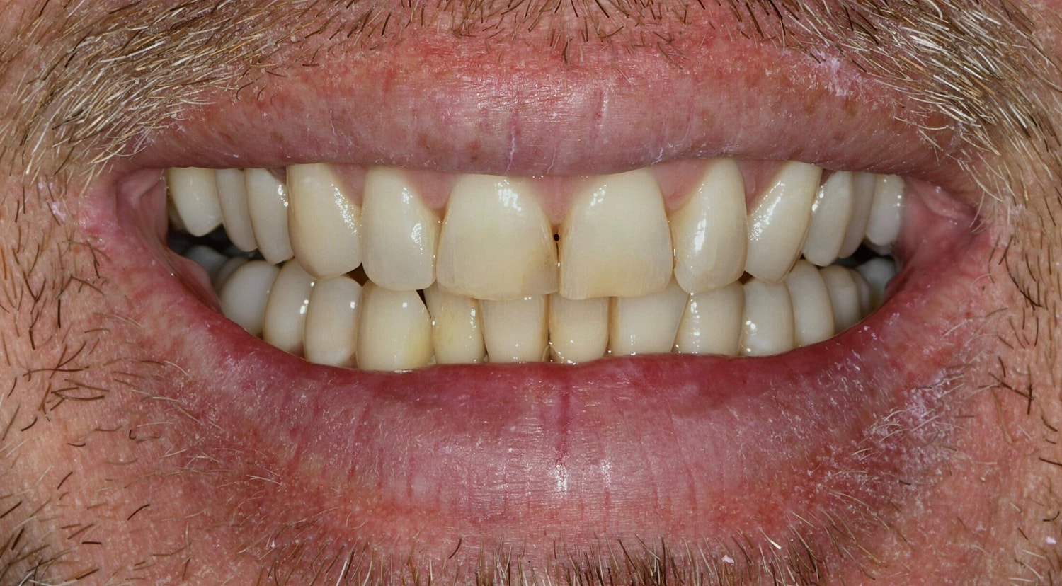 Patients Before & After