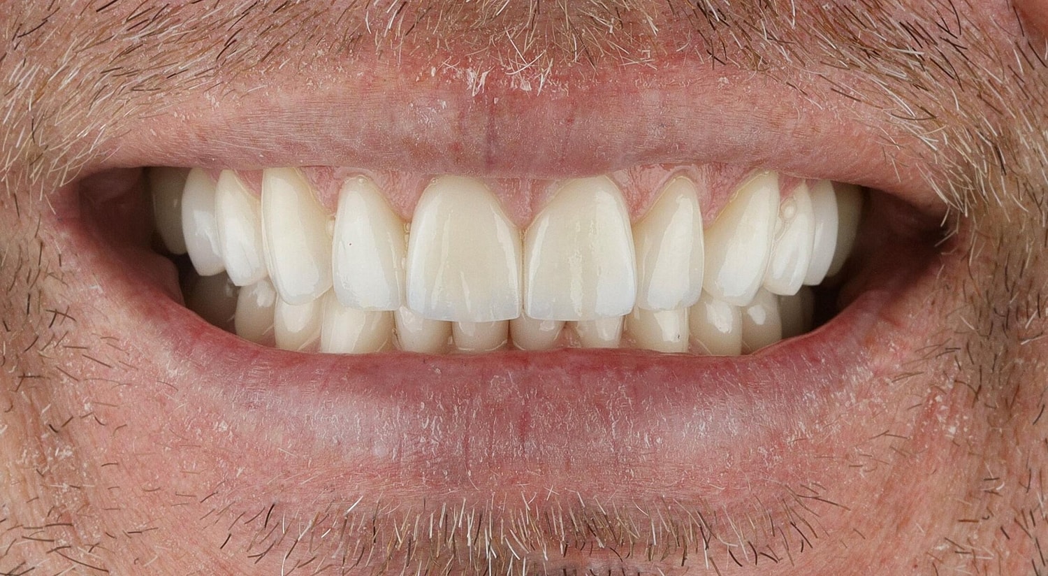 Patients Before & After
