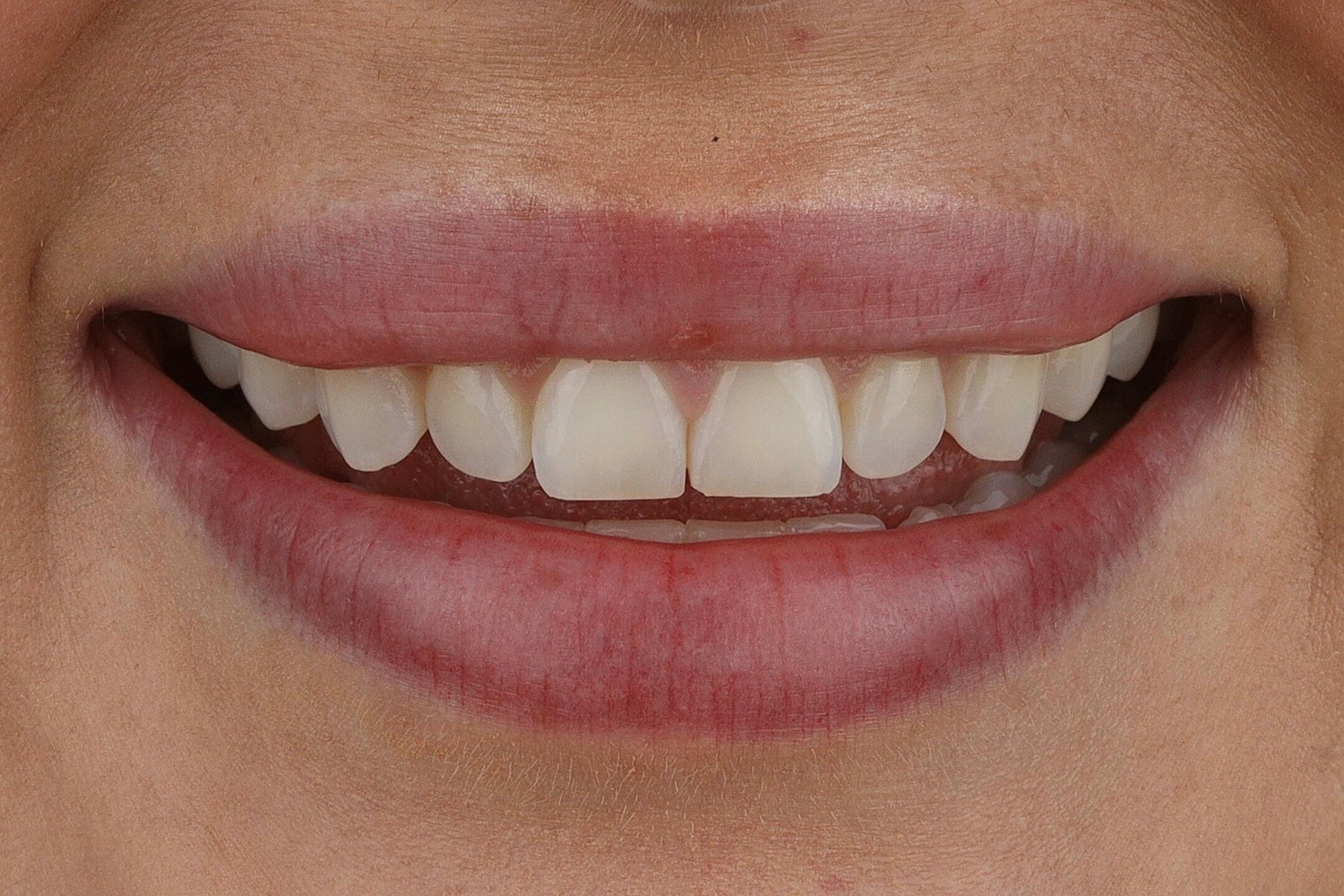 Patients Before & After