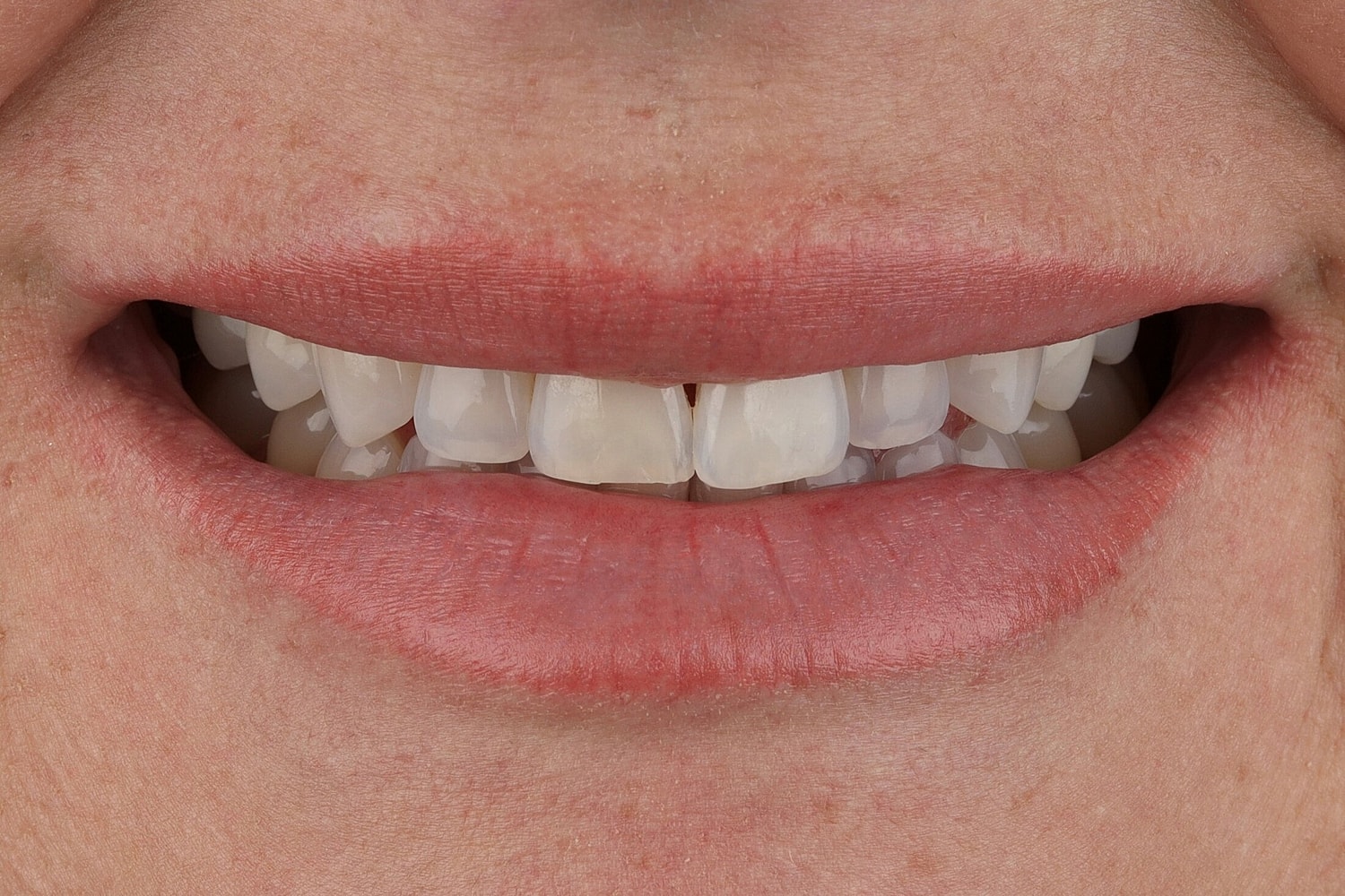 Patients Before & After