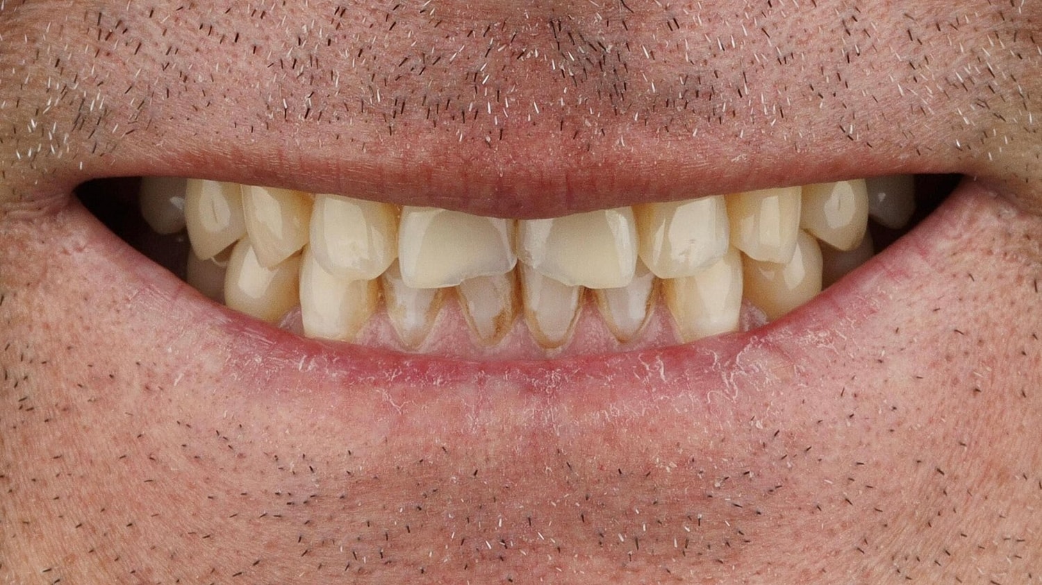 Patients Before & After