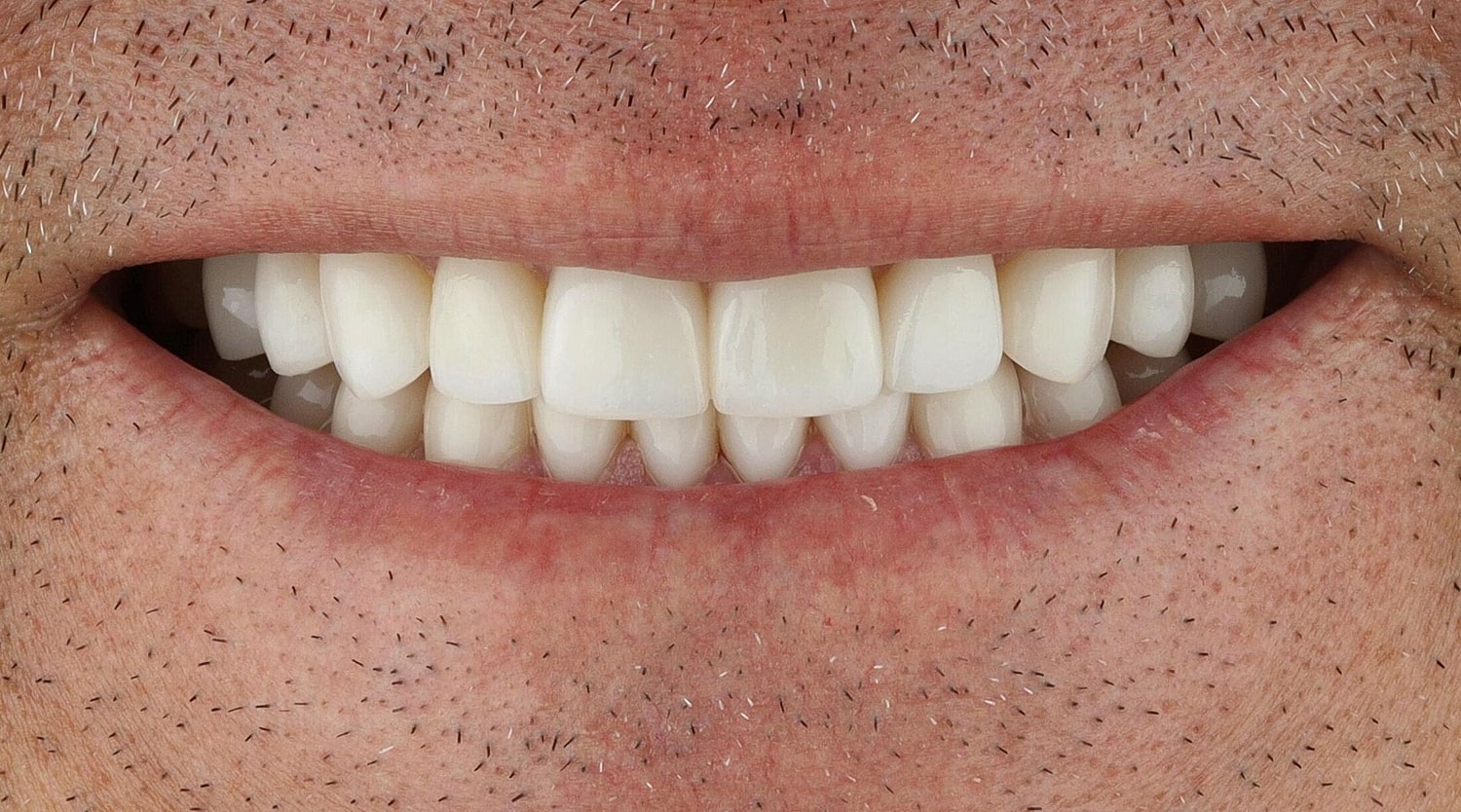 Patients Before & After