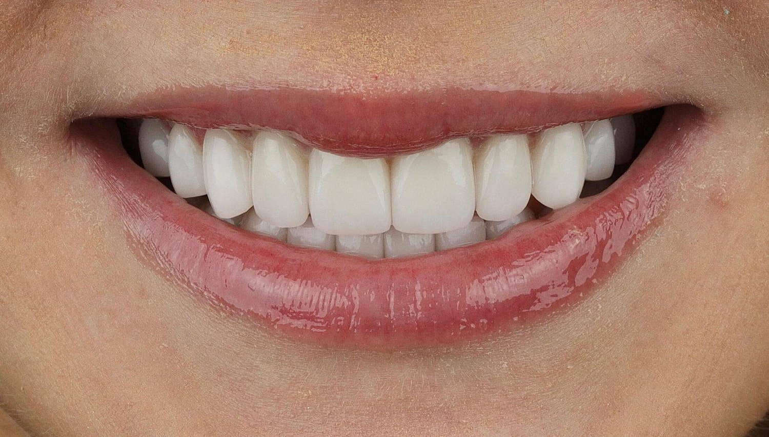 Patients Before & After