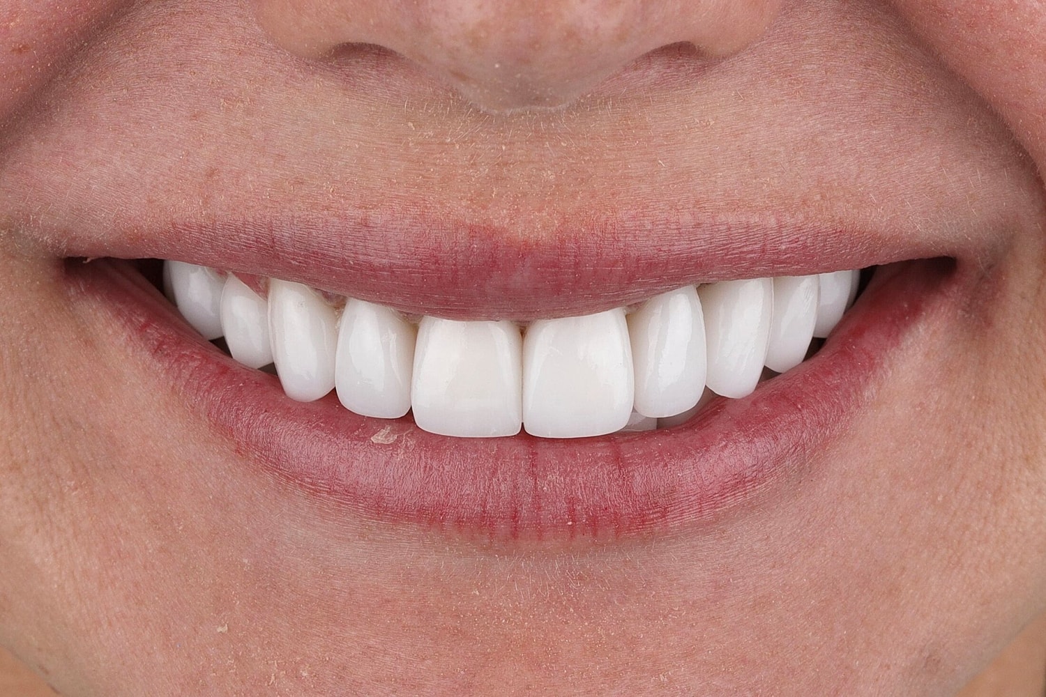 Patients Before & After