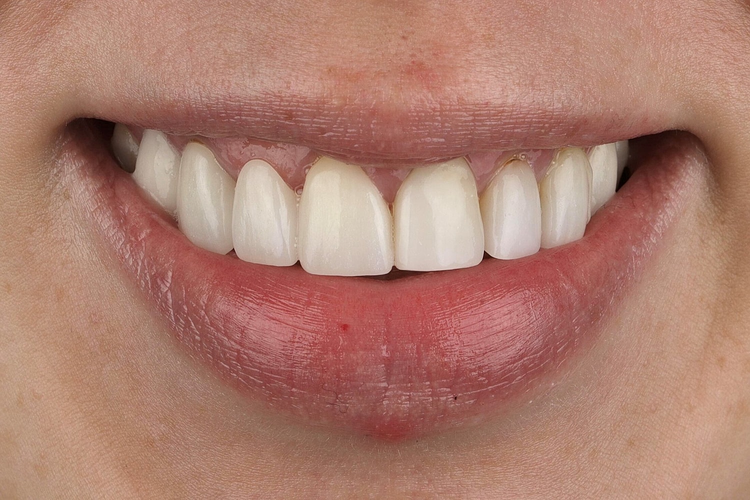 Patients Before & After