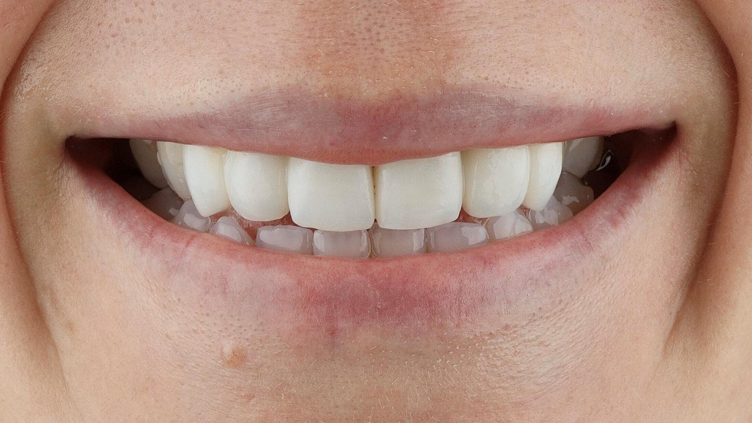Patients Before & After