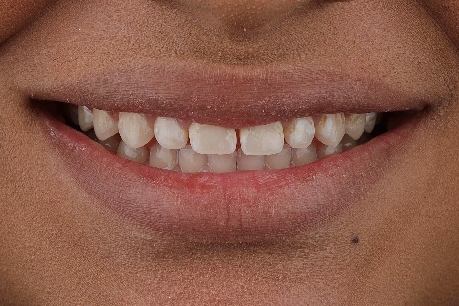 Patients Before & After