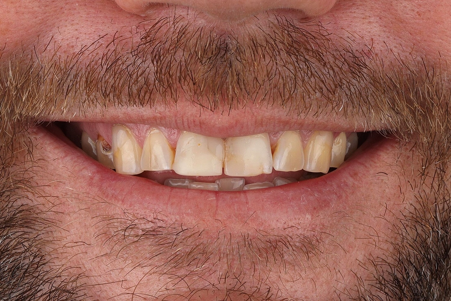 Patients Before & After