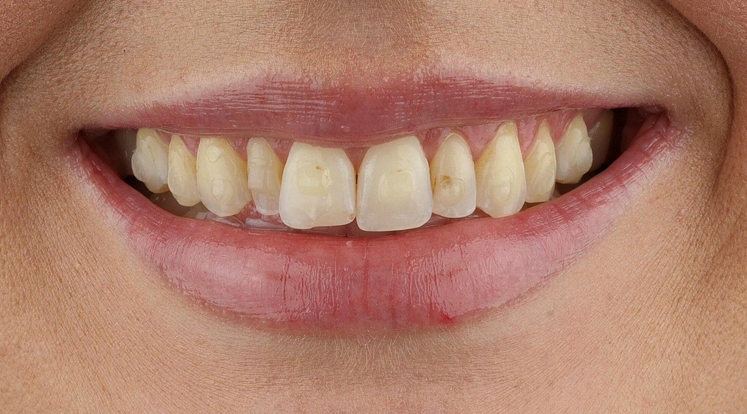 Patients Before & After