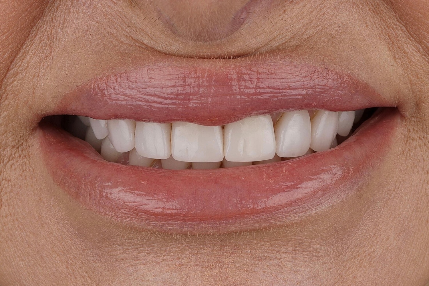 Patients Before & After