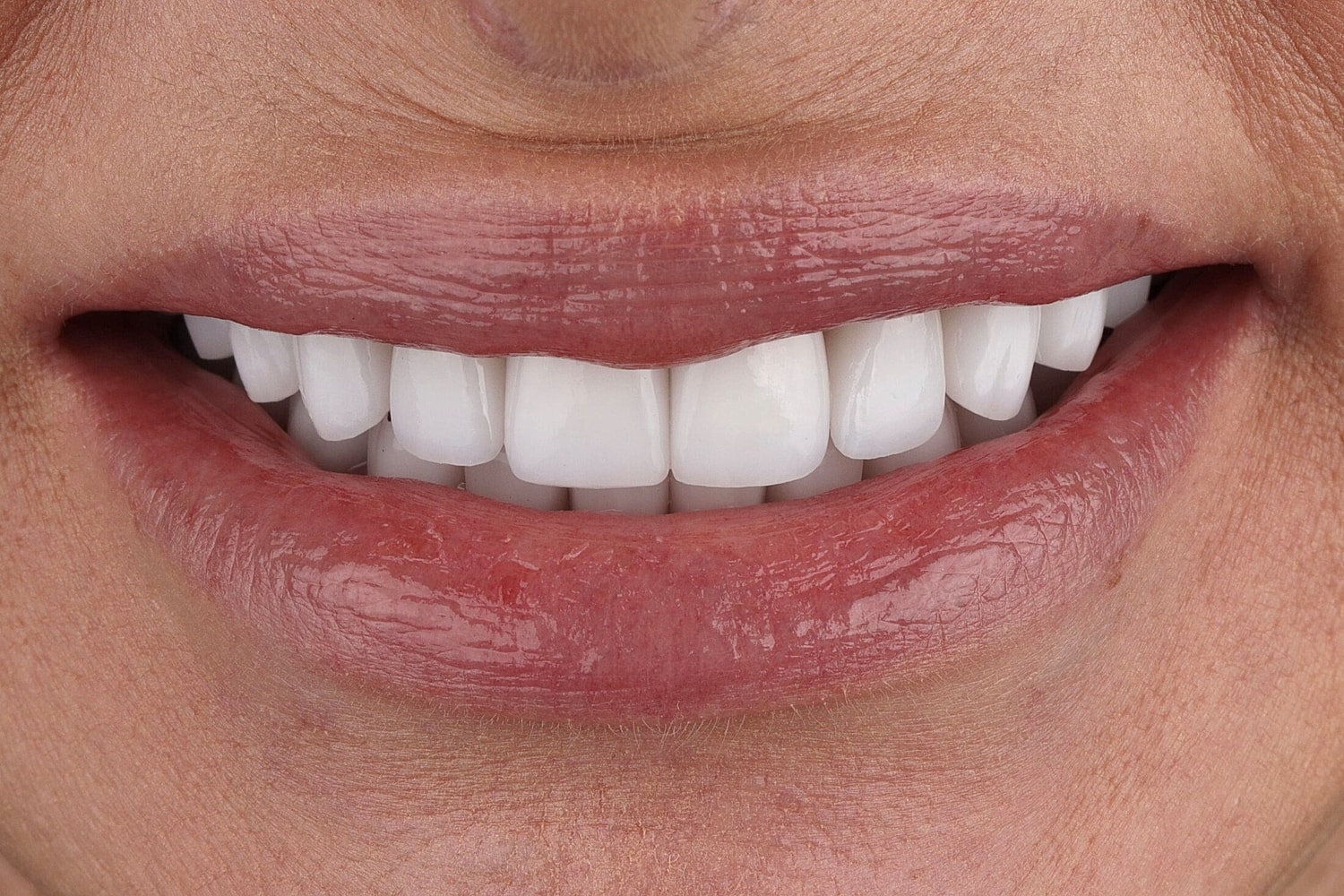 Patients Before & After