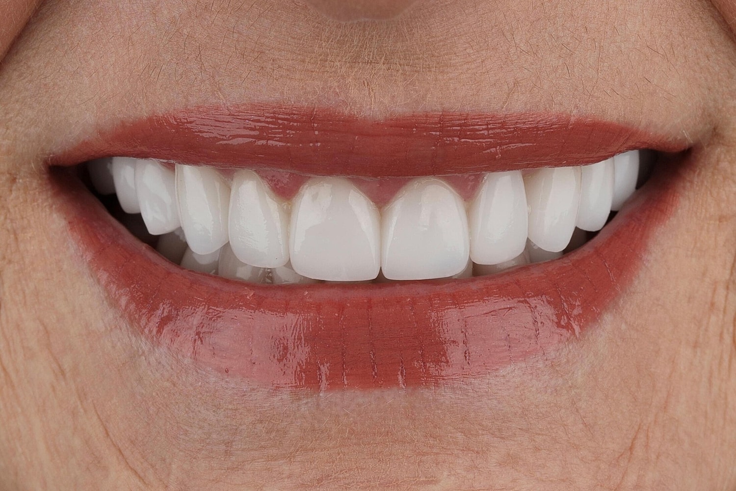 Patients Before & After