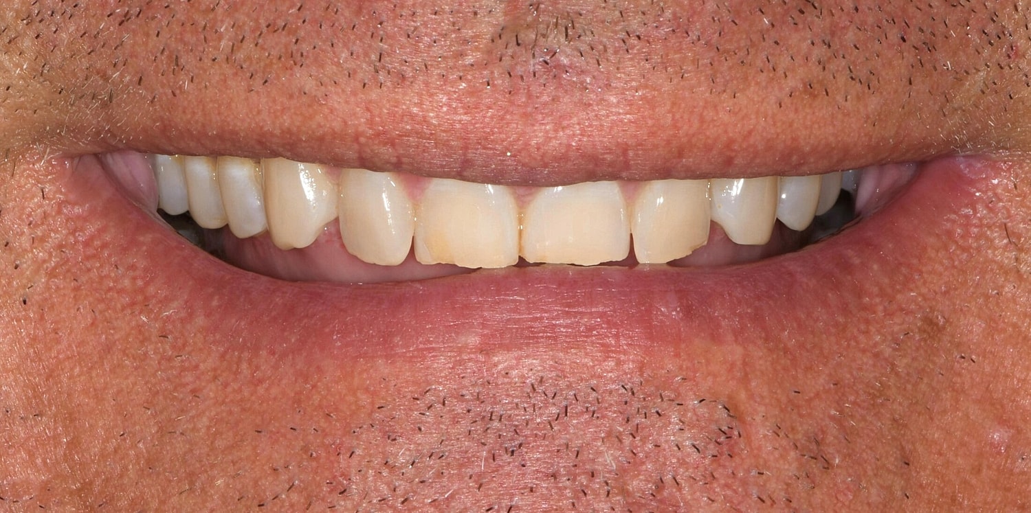 Patients Before & After