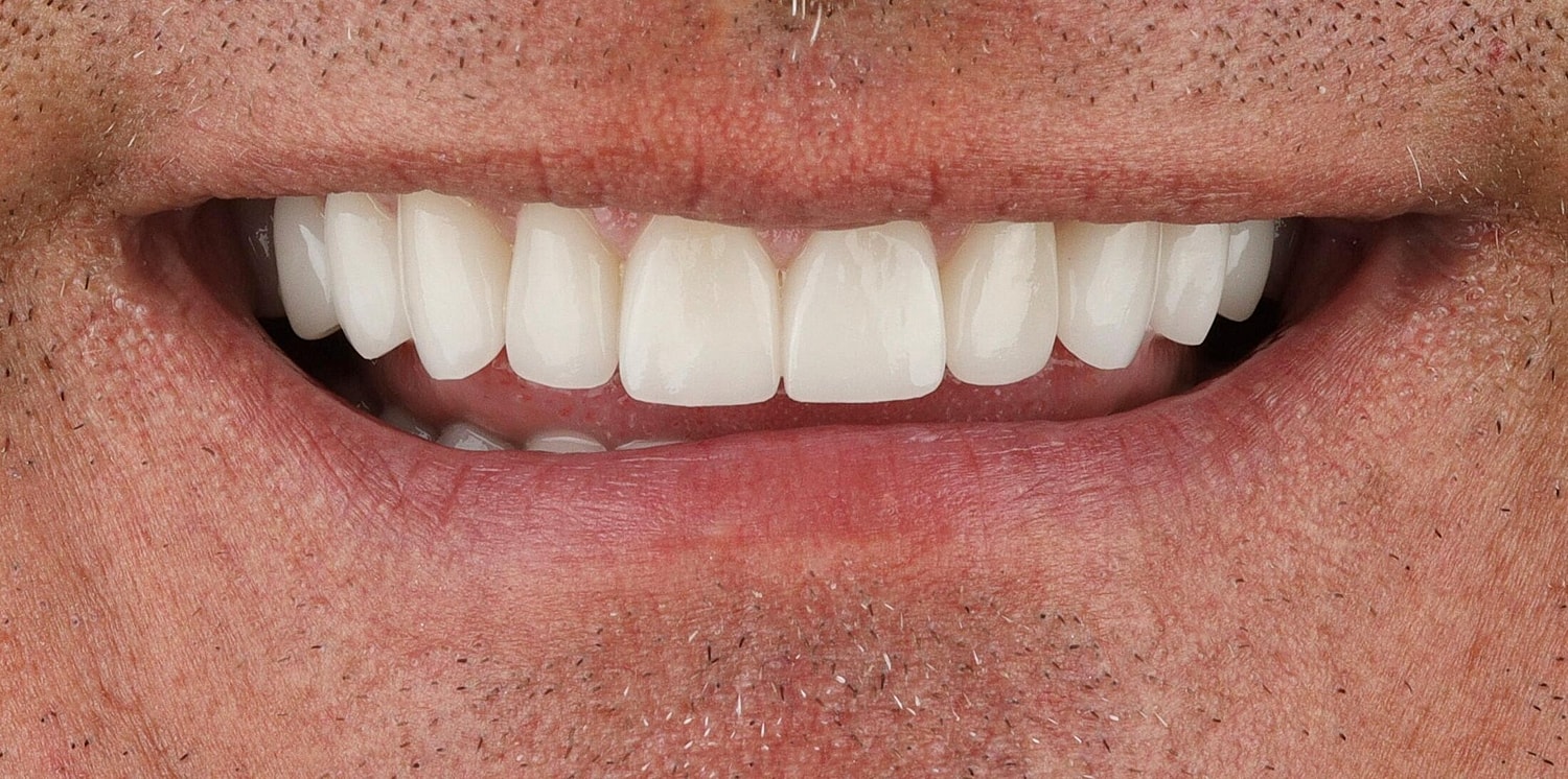 Patients Before & After