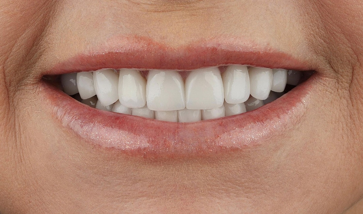 Patients Before & After