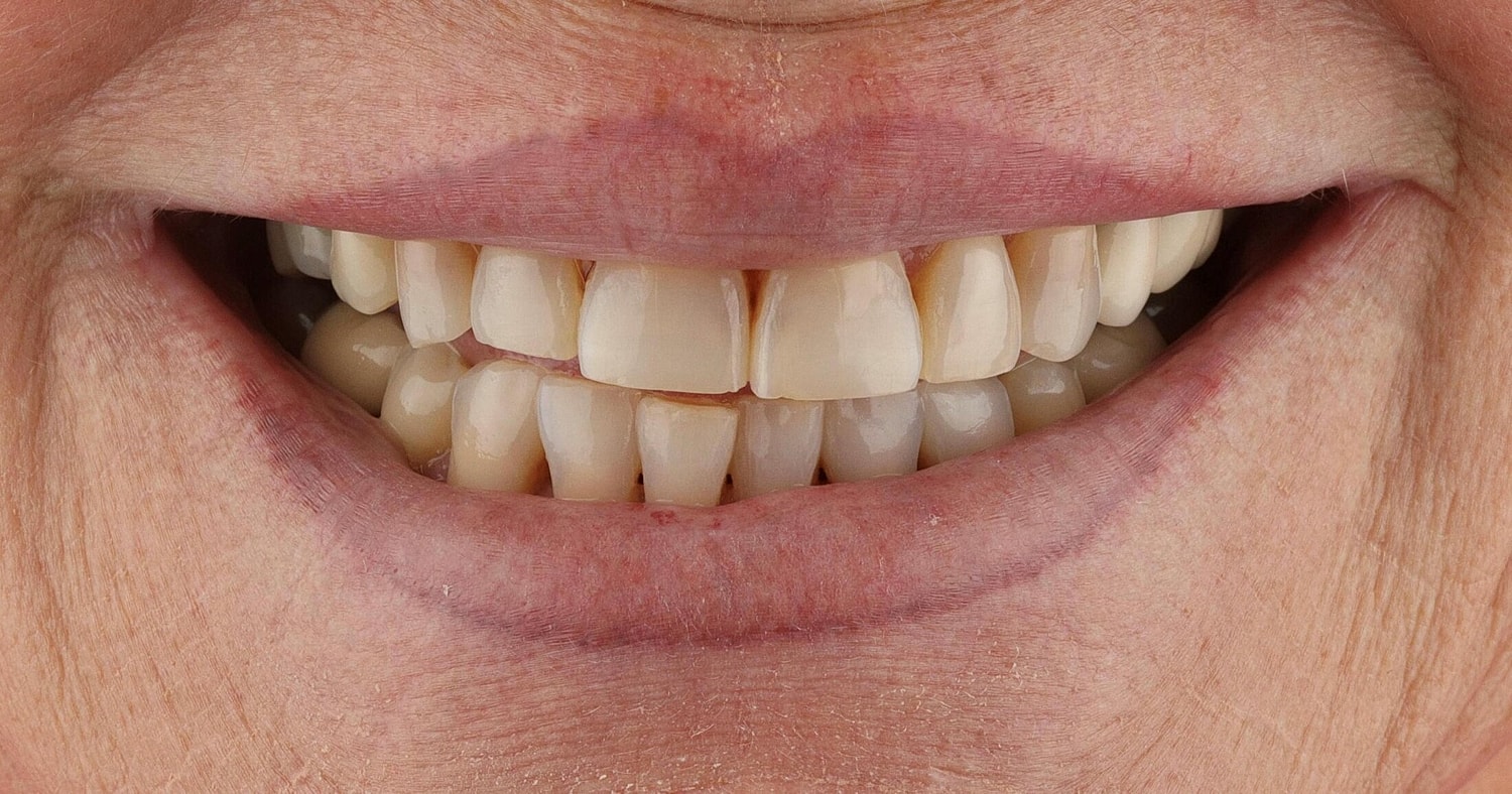 Patients Before & After
