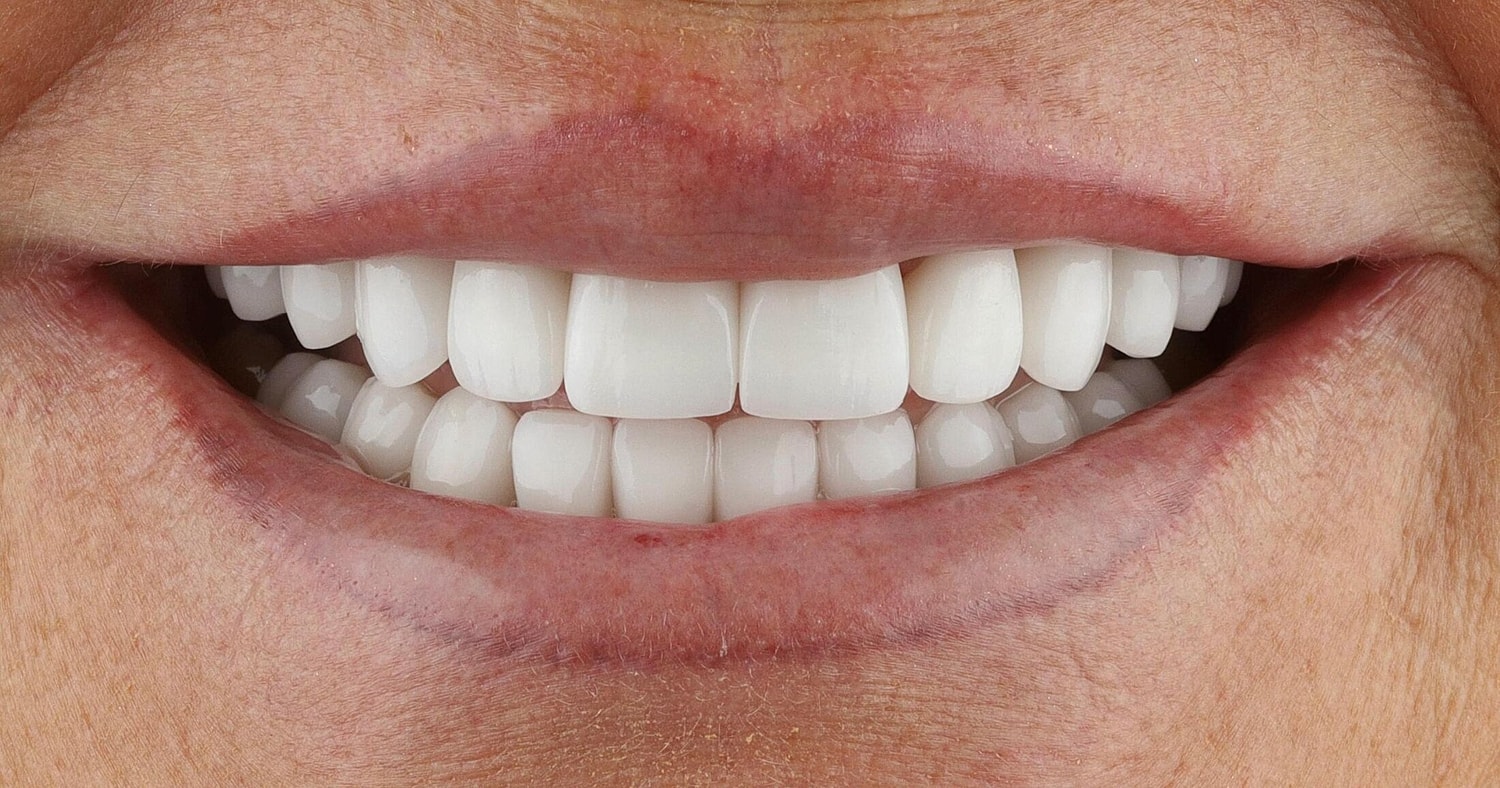 Patients Before & After