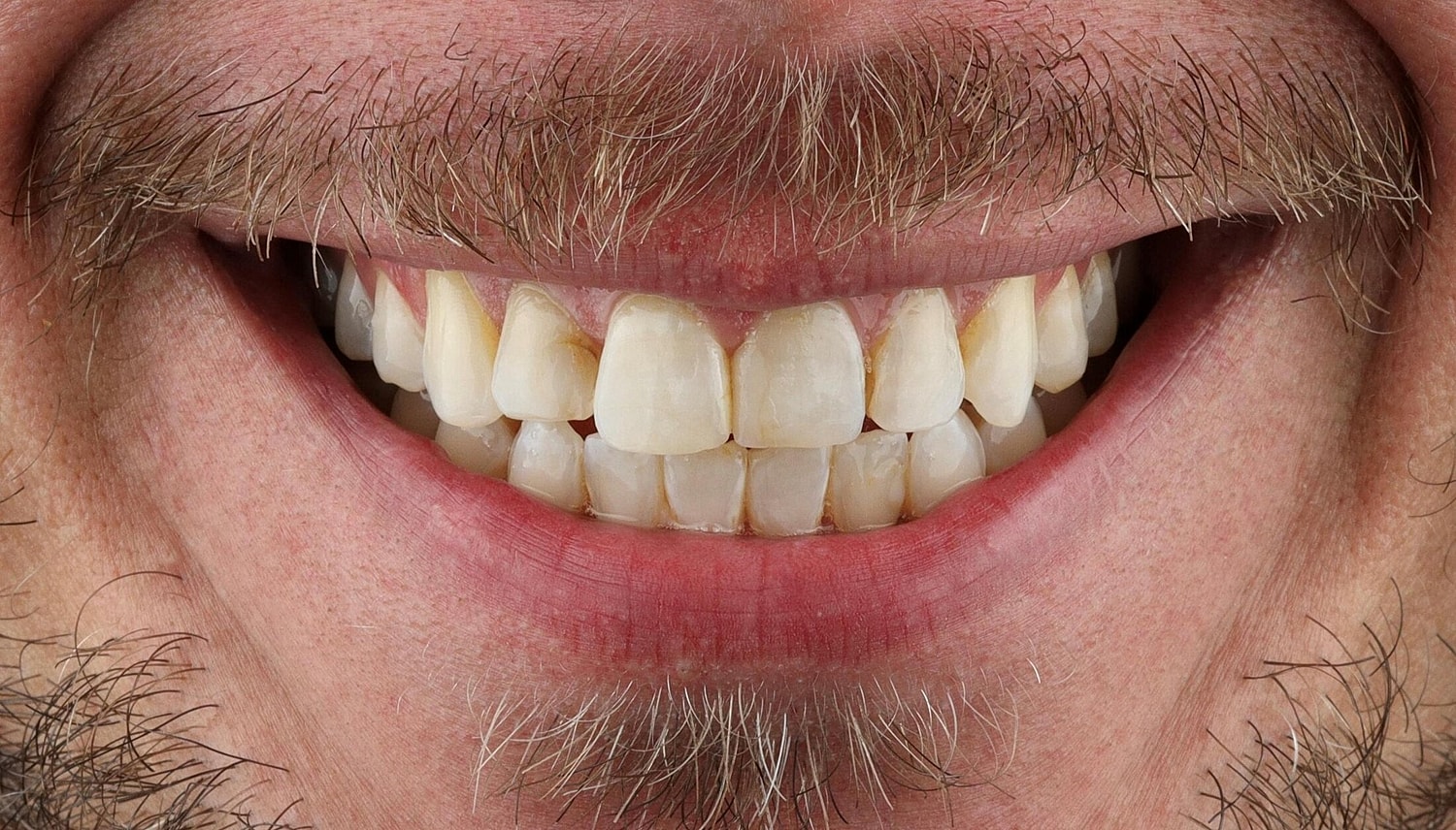 Patients Before & After