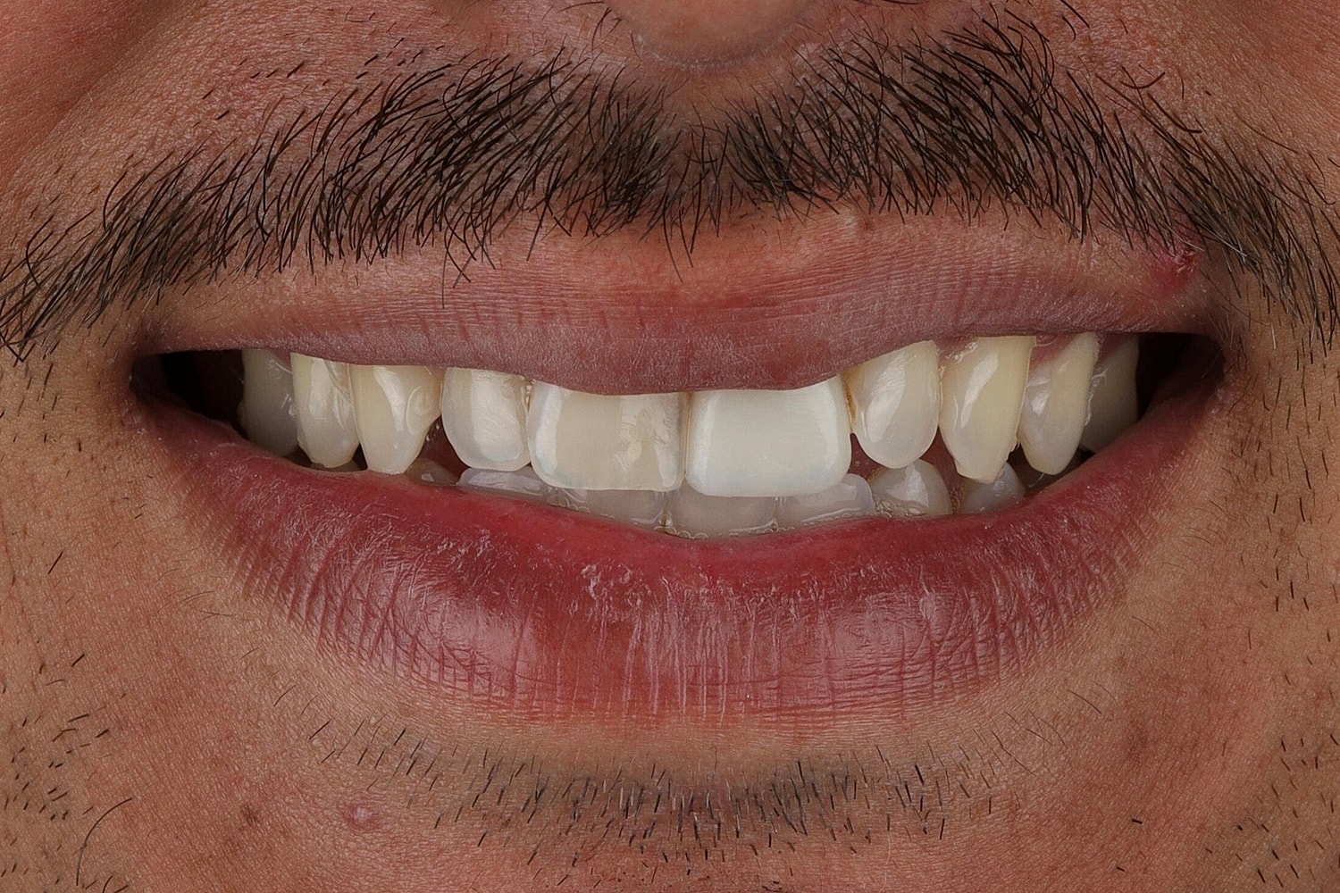 Patients Before & After