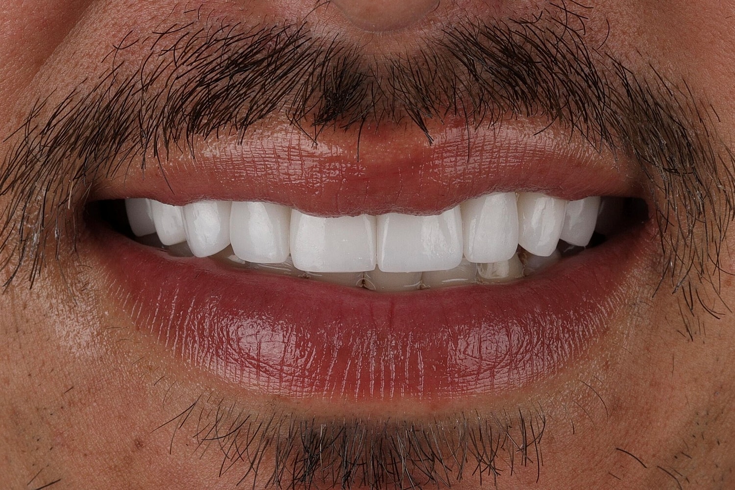 Patients Before & After