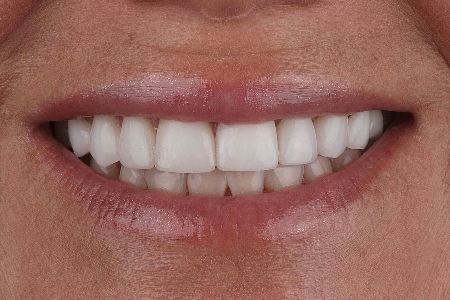 Patients Before & After