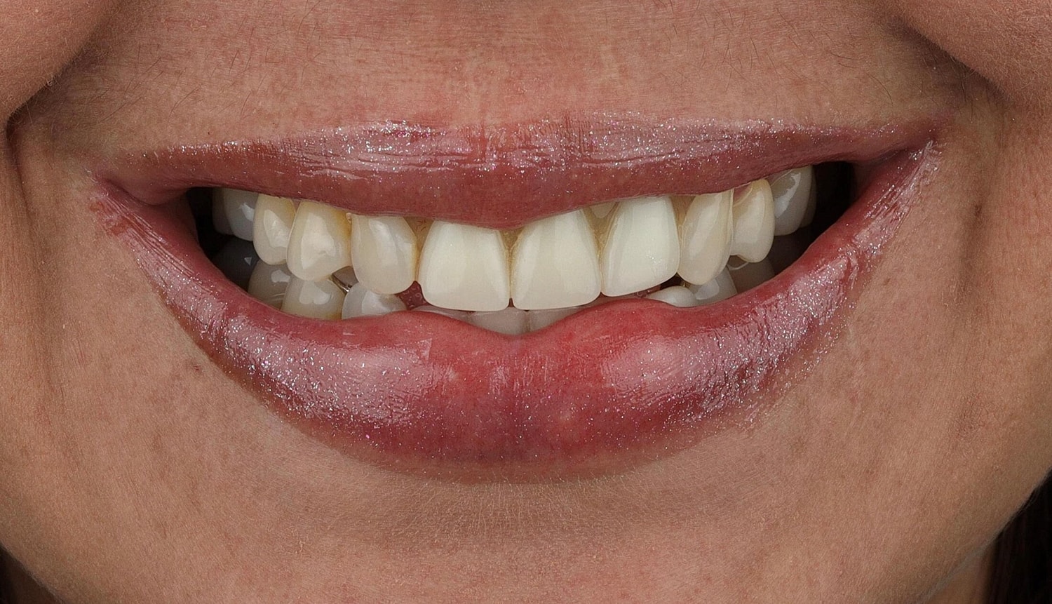 Patients Before & After