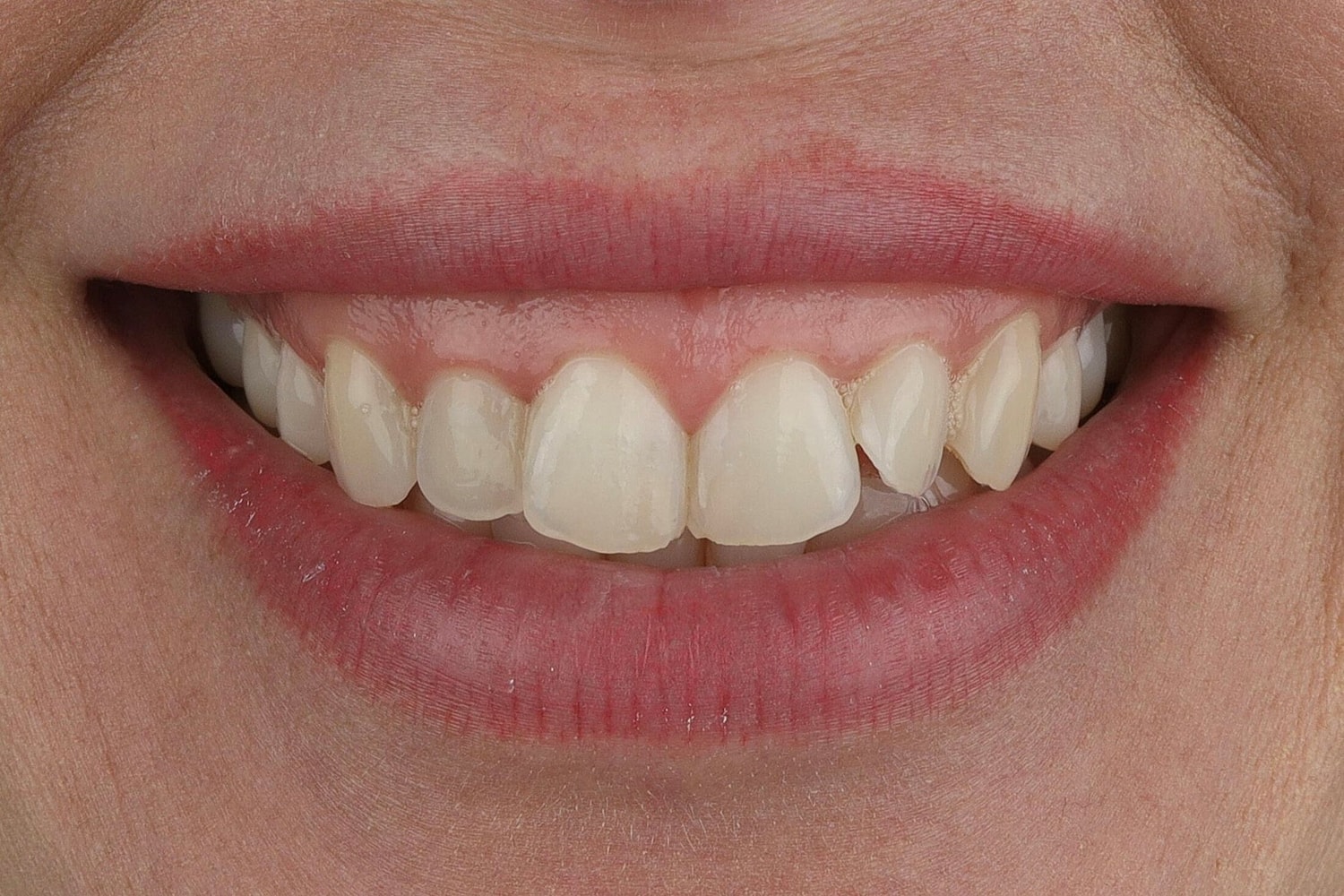 Patients Before & After