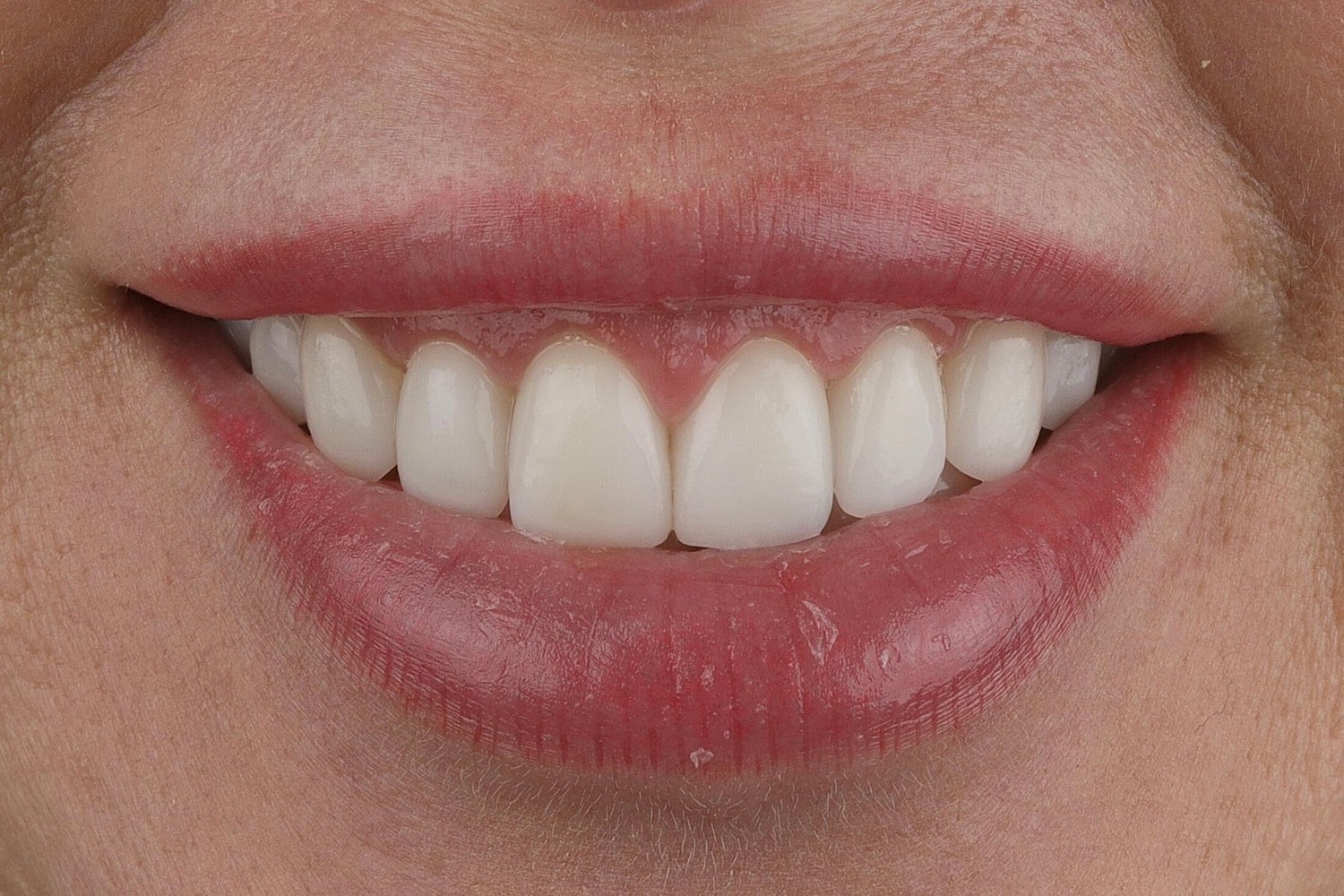 Patients Before & After