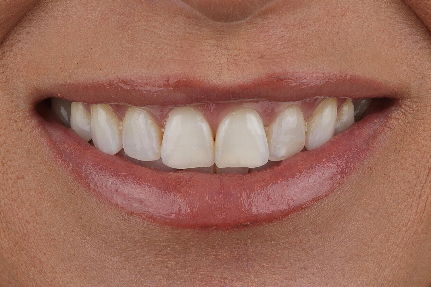 Patients Before & After